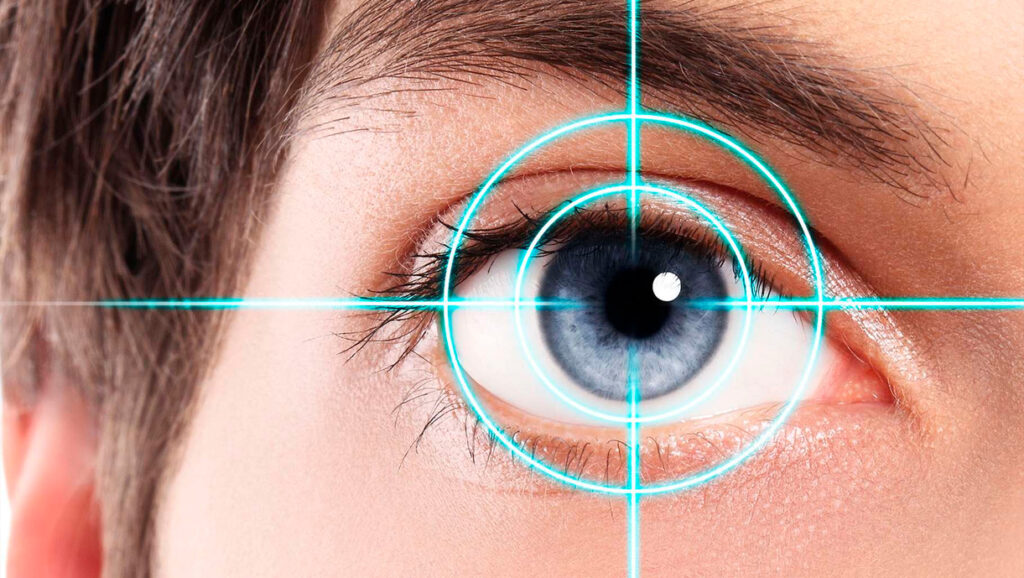 Cirurgia facorrefrativa